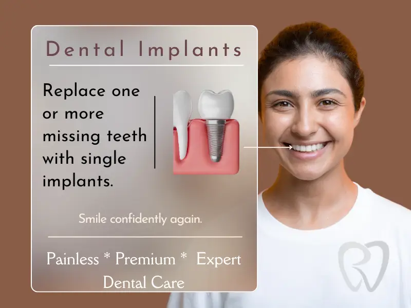 implants about 1