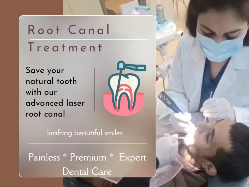 rct-about root canal treatment in hyderabad